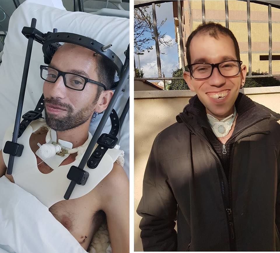 Oristano, Alan dopo l’incidente una vita a metà: una raccolta fondi per tornare alla normalità
