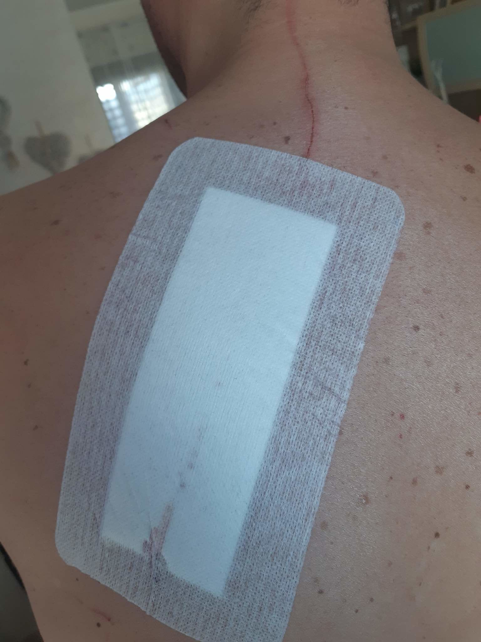 Villasor, aggredito da tre extracomunitari al Ristopizza: l’incubo del giovane Mattia Salis di Assemini