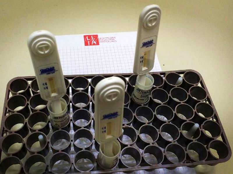 Cagliari, test gratis rapido per Hiv: operazione prevenzione contro l’Aids, ecco come fare