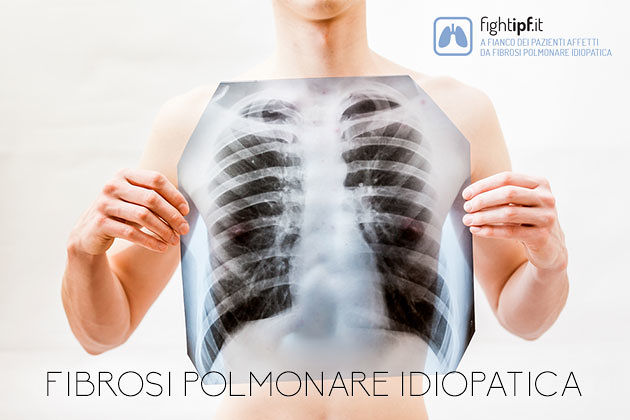 Nasce in Sardegna un’associazione che dà voce alle persone colpite da IPF e malattie rare del polmone