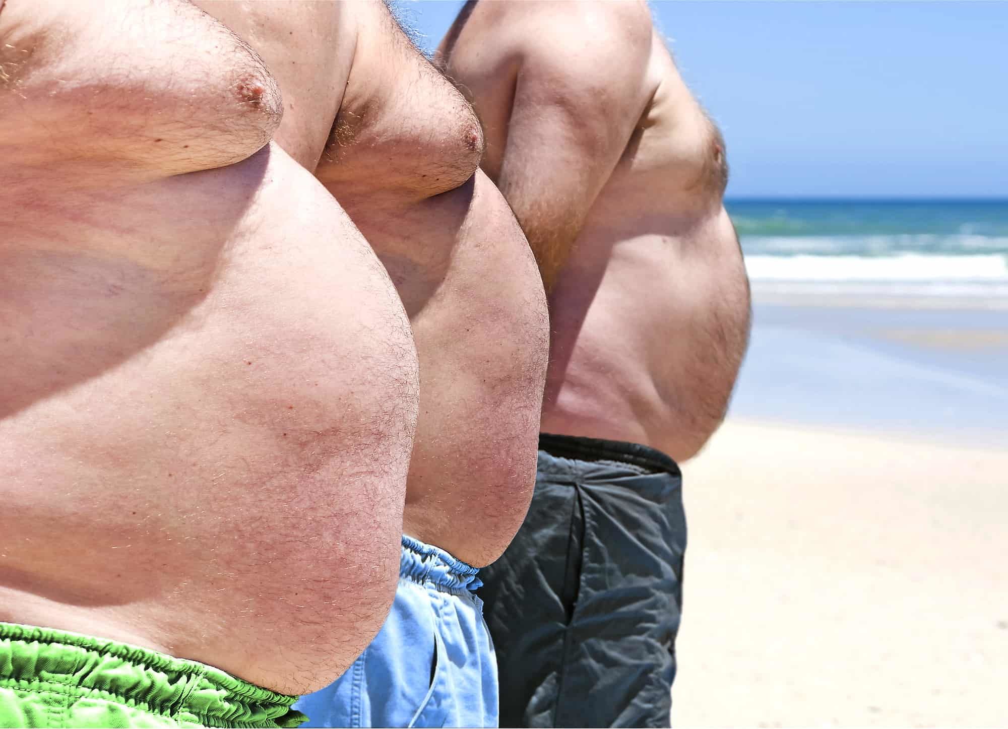 Obesity Day al Brotzu: come affrontare l’Epidemia globale che colpisce a tutte le età