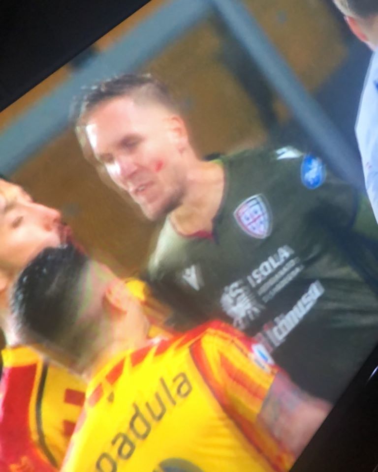 Un Cagliari “folle”, 2-2 raggiunto dal Lecce: manata di Olsen, fallo di mano volante di Cacciatore, due espulsioni fatali