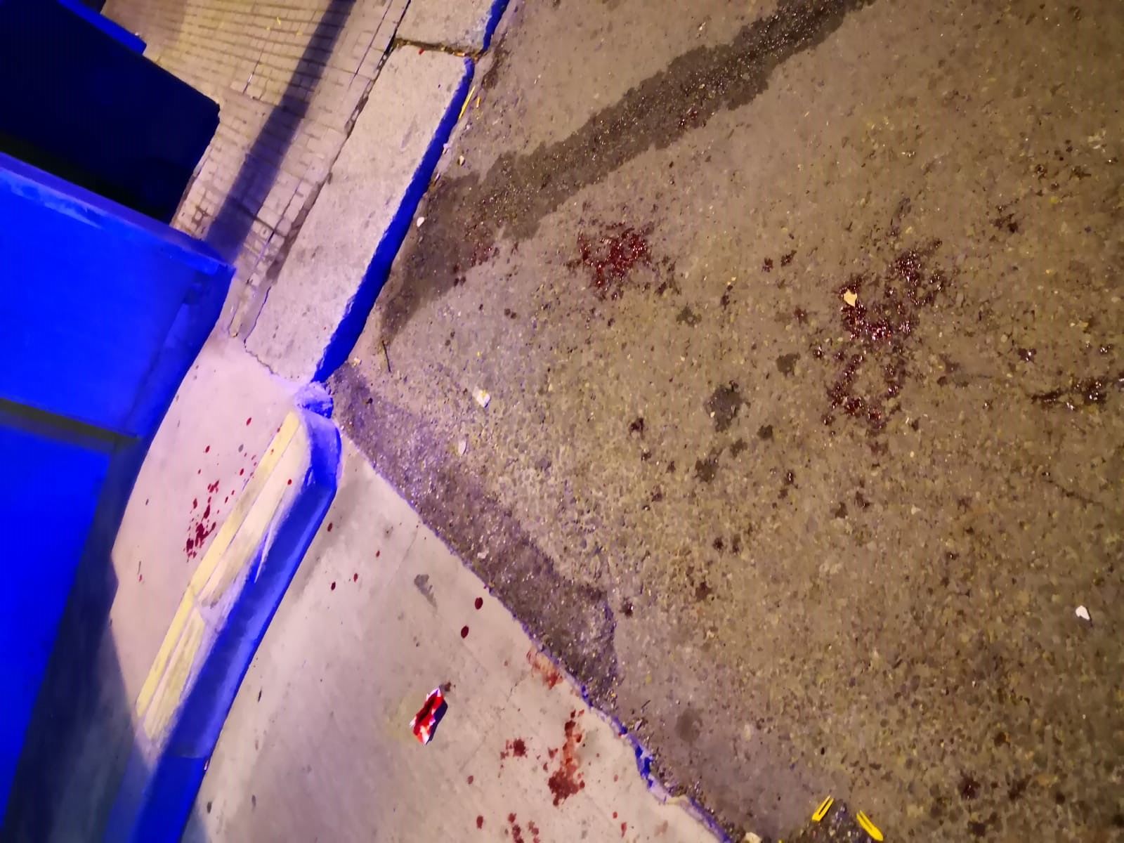 Cagliari, botte e sangue in via Caprera: due giovani aggrediti e feriti alla testa