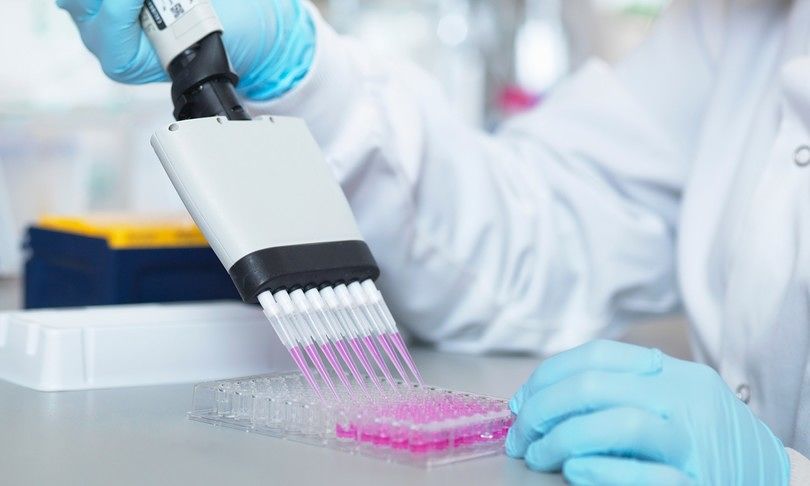Covid-19, 400 milioni di dosi del vaccino di Oxford saranno pronte a settembre
