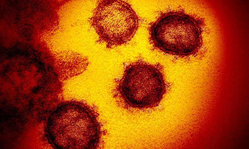 Studio Usa scopre pazienti pre-immuni al Sars-Cov-2: protetti per aver contratto l’influenza?