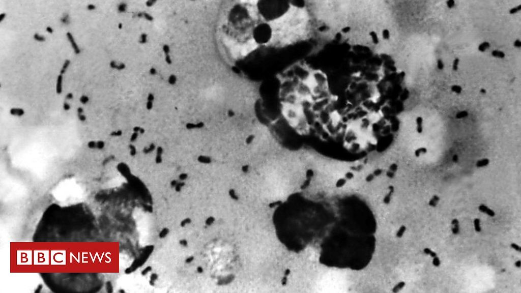 Che cos’è la peste bubbonica e come si trasmette all’uomo