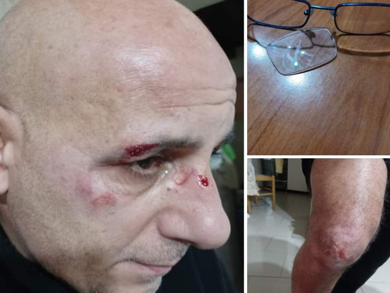 Cagliari, cade e si ferisce a Villanova: “Colpa dei lampioni spenti, il Comune deve risarcirmi”