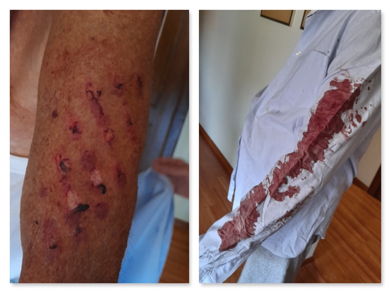 Cagliari, la rabbia di un passeggero al rientro da Trieste: “Caduto sulle scale mobili, in aeroporto neanche un medico”