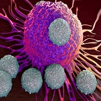 Rivoluzione per i malati di cancro: stai guarendo? Te lo dice un cerotto