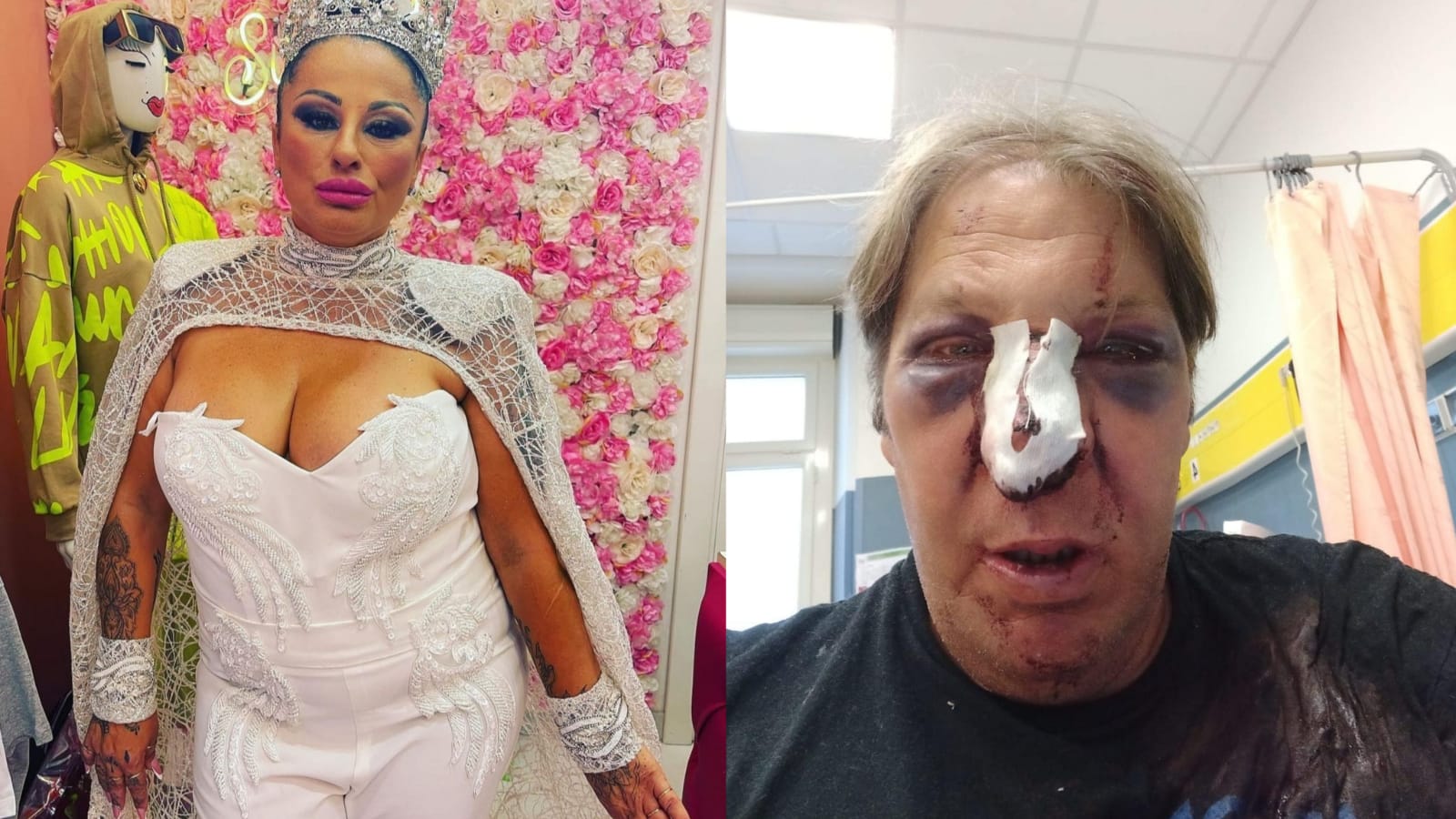 Cagliari, Antonello Lai pestato a Is Mirrionis dopo lo show della tiktoker “Svergognata”