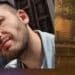 Assunto a tempo indeterminato da Poste Italiane ma muore di leucemia: addio a Luca Logias