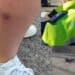 Cagliari, donna aggredita da un branco di cani randagi, la Polizia locale: “Problema conosciuto, sarà risolto a breve, invitiamo a segnalare”