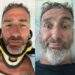 Incidente choc in moto per Corrado Sorrentino: “Sono rotto, grazie a chi mi ha salvato”