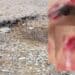 Assemini, buche trappola per pedoni e ciclisti: un ragazzo al pronto soccorso