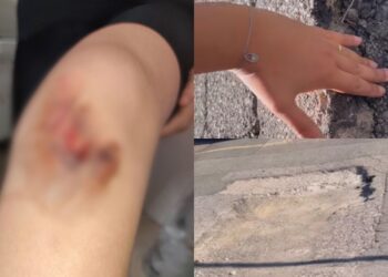 Sinnai, bimba inciampa e cade in una maxi voragine