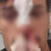 Occupano il posto riservato ai disabili e aggrediscono madre e figlio: “Non potevo stare in silenzio davanti a uno schifo del genere”