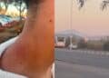 Ragazzini aggrediti al Poetto di Quartu: “Una rissa e tanti episodi di vandalismo, qui è il far west”