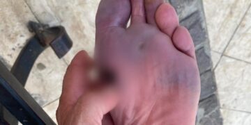 Cagliari, odissea alla guardia medica: per accedere occorre telefonare ma la linea è occupata da internet