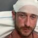 “Aggredito e picchiato da 30 persone sulla spiaggia in Sardegna perché gay”: la denuncia choc diventa un caso