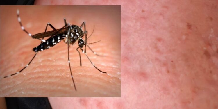 West Nile, aumentano i casi in Sardegna e sale la preoccupazione nel Medio Campidano dopo un decesso e un contagio a San Gavino